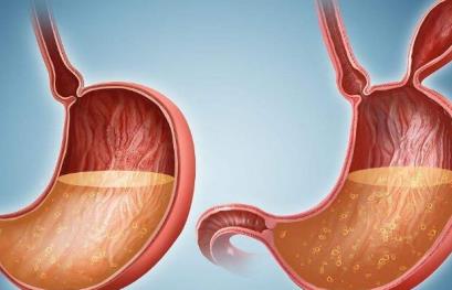 日本專家談腫瘤?胃癌